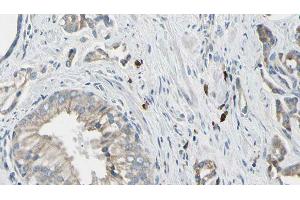ABIN6278532 at 1/100 staining Human prostate tissue by IHC-P. (STEAP1 Antikörper  (N-Term))