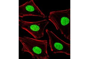 Fluorescent image of Hela cells stained with POLDIP3 Antibody (N-term) (ABIN1881667 and ABIN2838983). (POLDIP3 Antikörper  (N-Term))