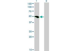 Western Blot analysis of SMOC1 expression in transfected 293T cell line by SMOC1 monoclonal antibody (M03), clone 8F10. (SMOC1 Antikörper  (AA 150-221))