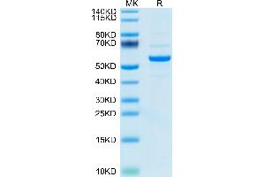 Mouse Pentraxin 2 on Tris-Bis PAGE under reduced condition. (APCS Protein (AA 21-224) (Fc Tag))