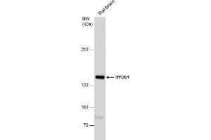 WB Image HYOU1 antibody detects HYOU1 protein by western blot analysis.
