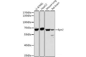 Western blot analysis of extracts of various cell lines using Epn2 Polyclonal Antibody at dilution of 1:1000. (Epsin 2 Antikörper)
