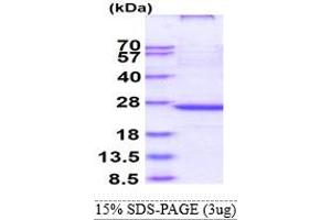 SDS-PAGE (SDS) image for Oxidized Low Density Lipoprotein (Lectin-Like) Receptor 1 (OLR1) (AA 58-273) protein (ABIN667547)