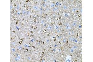 Immunohistochemistry of paraffin-embedded Rat brain using NTF4 Polyclonal Antibody at dilution of 1:100 (40x lens). (Neurotrophin 4 Antikörper)