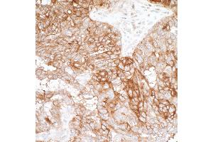Immunohistochemistry (IHC) image for anti-V-Set Domain Containing T Cell Activation Inhibitor 1 (VTCN1) (AA 30-282) antibody (ABIN7454028)