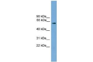 WB Suggested Anti-RIC8A Antibody Titration: 0. (RIC8A Antikörper  (N-Term))