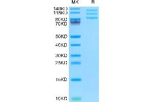 Mouse ITGAV&ITGB8 on Tris-Bis PAGE under reduced condition. (Integrin alpha V beta 8 (ITGAV & ITGB8) Heterodimer (AA 31-988) protein (His tag))