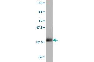 Western Blotting (WB) image for anti-Chemokine (C-X-C Motif) Ligand 1 (Melanoma Growth Stimulating Activity, Alpha) (CXCL1) (AA 36-107) antibody (ABIN561149)