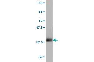 Western Blot detection against Immunogen (33. (CXCL1 Antikörper  (AA 36-107))