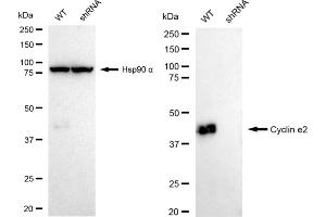 Western blotting analysis using Cyclin e2 antibody (ABIN7798199). (Rekombinanter Cyclin E2 Antikörper)