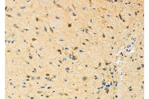 ABIN6265330 and ABIN6273170 at 1/100 staining Mouse brain tissue by IHC-P. (STBD1 Antikörper  (N-Term))