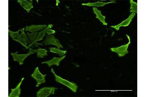 Immunofluorescence of monoclonal antibody to CKS2 on HeLa cell. (CKS2 Antikörper  (AA 1-79))