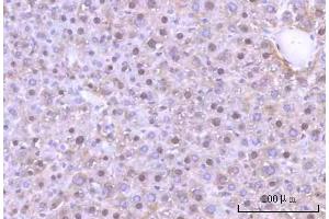 IHC analysis of Nesprin3/SYNE3 using anti-Nesprin3/SYNE3 antibody (ABIN7601328). (Nesprin3 Antikörper  (AA 322-495))