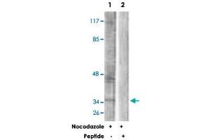 Western blot analysis of extracts from COS-7 cells, treated with Nocodazole (1 ug/mL, 16 hours), using PBK polyclonal antibody . (PBK Antikörper)
