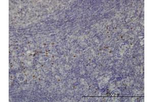 Immunoperoxidase of monoclonal antibody to TCF12 on formalin-fixed paraffin-embedded human tonsil. (TCF12 Antikörper  (AA 364-453))