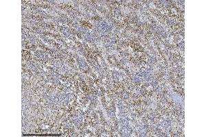 IHC analysis of Integrin linked ILK using anti-Integrin linked ILK antibody (ABIN7599410). (ILK Antikörper  (AA 1-452))