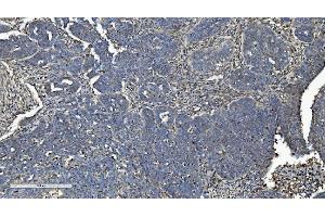 IHC analysis of L/CMBL using anti-L/CMBL antibody (ABIN7599150). (CMBL Antikörper  (AA 1-246))