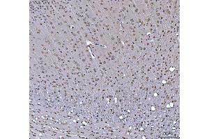 IHC analysis of RTCB using anti-RTCB antibody (ABIN7600722).