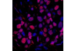 Immunofluorescence (IF) image for anti-RAD23 Homolog B (RAD23B) (AA 359-409) antibody (ABIN7449006) (RAD23B Antikörper  (AA 359-409))