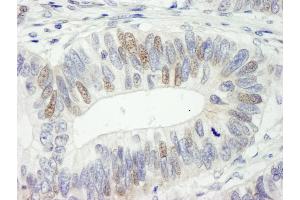 anti-High Mobility Group Box 3 (HMGB3) (AA 125-175) antibody