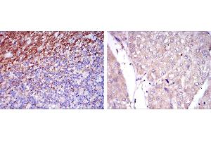 Immunohistochemical analysis of paraffin-embedded human cerebellum tissues (left) and human liver cancer tissues (right) using CD15 mouse mAb with DAB staining. (CD15 Antikörper)