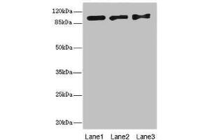 Western blot All lanes: EXO1 antibody at 10 μg/mL Lane 1: Hela whole cell lysate Lane 2: 293T whole cell lysate Lane 3: A549 whole cell lysate Secondary Goat polyclonal to rabbit IgG at 1/10000 dilution Predicted band size: 95, 90 kDa Observed band size: 95 kDa (Exonuclease 1 Antikörper  (AA 301-600))