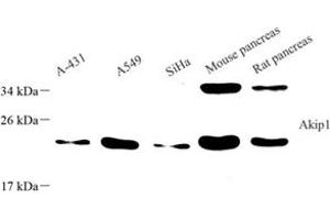 Western blot analysis of Akip1 (ABIN7072871) at dilution of 1: 800 (AKIP1 Antikörper)