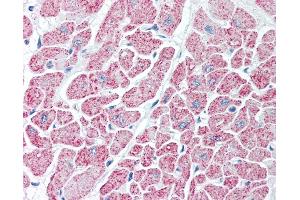 Anti-IDH antibody IHC of human heart. (Isocitrate Dehydrogenase Antikörper)