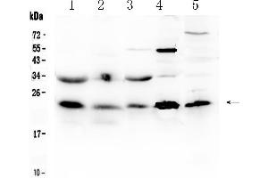 Western blot analysis of HSPB8/Hsp22 using anti- HSPB8/Hsp22 antibody . (HSPB8 Antikörper  (AA 1-196))