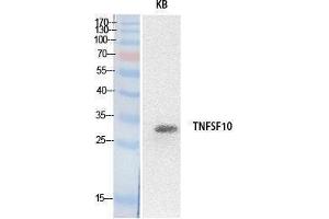 Western Blotting (WB) image for anti-Tumor Necrosis Factor (Ligand) Superfamily, Member 10 (TNFSF10) (Internal Region) antibody (ABIN3178527) (TRAIL Antikörper  (Internal Region))