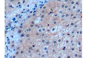 Detection of ICOSLG in Human Liver Tissue using Polyclonal Antibody to Inducible T-Cell Co Stimulator Ligand (ICOSLG) (ICOSLG Antikörper  (AA 23-249))