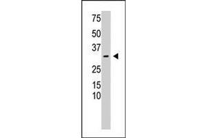 The RCAN3 polyclonal antibody  is used in Western blot to detect RCAN3 in mouse heart tissue lysate. (RCAN3 Antikörper  (N-Term))
