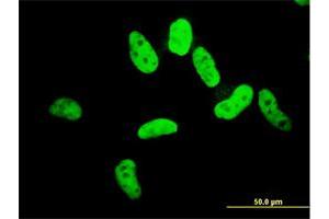 Immunofluorescence of monoclonal antibody to ZNF207 on HeLa cell. (ZNF207 Antikörper  (AA 1-110))