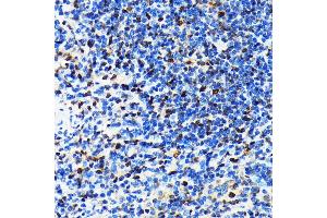 Immunohistochemistry of paraffin-embedded rat spleen using CRM1/XPO1 antibody (ABIN7267067) at dilution of 1:100 (40x lens). (XPO1 Antikörper)