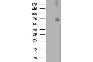 Western Blotting (WB) image for anti-IlvB (Bacterial Acetolactate Synthase)-Like (ILVBL) antibody (ABIN1498881) (ILVBL Antikörper)