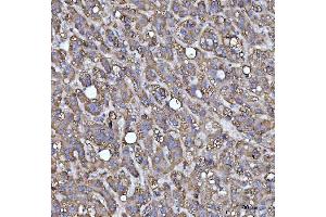 IHC analysis of MRPS22 using anti-MRPS22 antibody (ABIN7600613). (MRPS22 Antikörper  (AA 21-329))