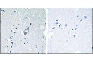 Immunohistochemistry analysis of paraffin-embedded human brain, using SAPK/JNK (Phospho-Tyr185) Antibody. (SAPK, JNK (AA 151-200), (pTyr185) Antikörper)