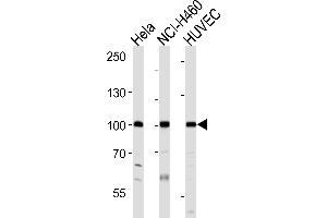 Western blot analysis of lysates from Hela, NCI-H460, HUVEC cell line (from left to right), using EPHA4 Antibody (R890) at 1:1000 at each lane. (EPH Receptor A4 Antikörper  (C-Term))