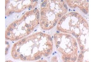 DAB staining on IHC-P; Samples: Human Kidney Tissue (LAMB2 Antikörper  (AA 38-350))
