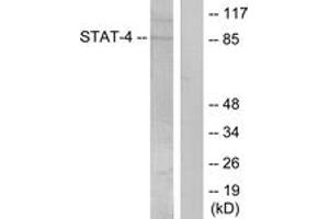Western blot analysis of extracts from HeLa cells treated with IL-4, using STAT4 (Phospho-Tyr693) Antibody.