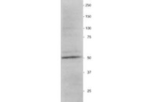 Western Blotting (WB) image for anti-Vimentin (VIM) antibody (ABIN955516) (Vimentin Antikörper)