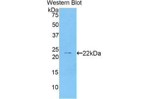 Western Blotting (WB) image for anti-Cathelicidin Antimicrobial Peptide (CAMP) (AA 31-170) antibody (ABIN1858227) (Cathelicidin Antikörper  (AA 31-170))