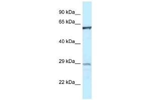 Western Blot showing PTPN6 antibody used at a concentration of 1 ug/ml against THP-1 Cell Lysate (SHP1 Antikörper  (Middle Region))