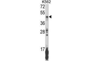 Western Blotting (WB) image for anti-Killer Cell Immunoglobulin-Like Receptor, Two Domains, Long Cytoplasmic Tail, 5B (KIR2DL5B) antibody (ABIN3003959) (KIR2DL5B Antikörper)