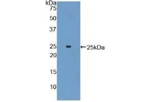 Detection of Recombinant ADCY6, Mouse using Polyclonal Antibody to Adenylate Cyclase 6 (ADCY6)
