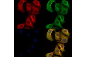 ABIN6261918 and ABIN6278469 staining Hela cells by IF/ICC. (GUCY1B2 Antikörper  (C-Term))