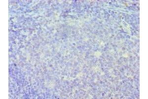 Immunohistochemistry of paraffin-embedded human tonsil tissue using ABIN7156635 at dilution of 1:100 (IRF8 Antikörper  (AA 137-426))