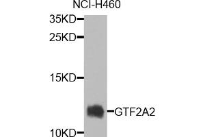 Western blot analysis of extracts of NCI-H460 cells, using GTF2A2 antibody. (GTF2A2 Antikörper)