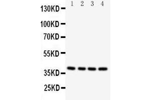 Western Blotting (WB) image for anti-Caspase 12 (Gene/pseudogene) (CASP12) (AA 71-84), (N-Term) antibody (ABIN3042658) (Caspase 12 Antikörper  (N-Term))