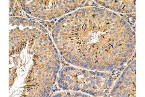 ABIN6260360 and ABIN6276505 at 1/100 staining Mouse testis tissue by IHC-P.